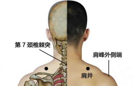 ?健康問答 | 緩解頸椎“職業(yè)病”，如何進行中醫(yī)調(diào)理？