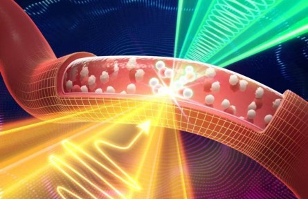 太赫茲+聲波！我國(guó)科學(xué)家使無(wú)針血鈉檢測(cè)成為可能